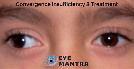Convergence Exercises: Symptoms of Insufficiency & Treatment