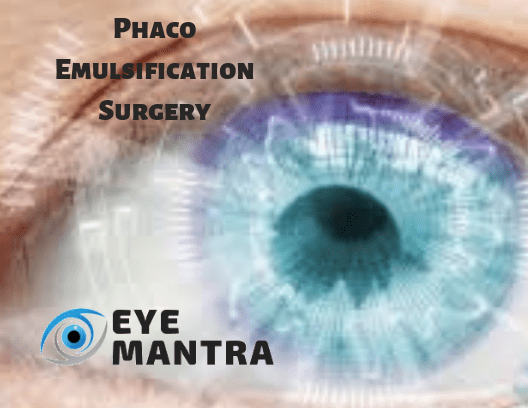 Phaco Surgery | Types – Regular or Micro | IOLs & Equipments |