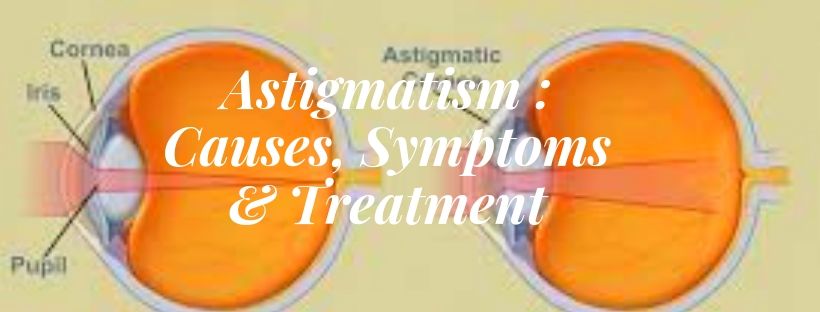 Astigmatism : Causes, Symptoms & Treatment