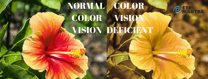 Color blindness