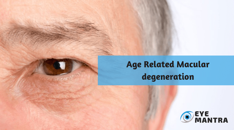 Age Related Macular Degeneration