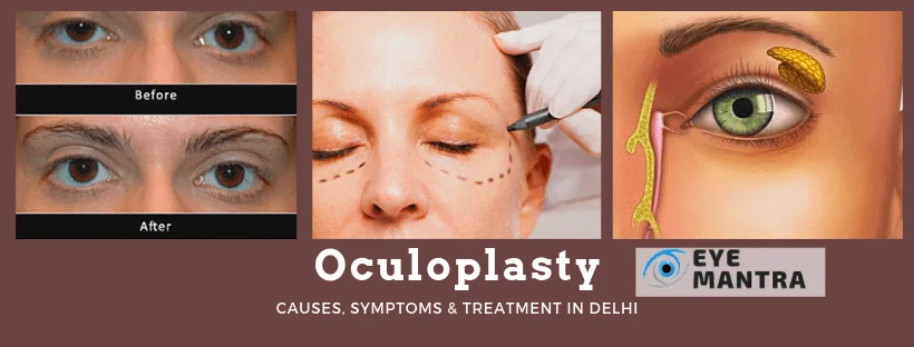 Oculoplasty Guide