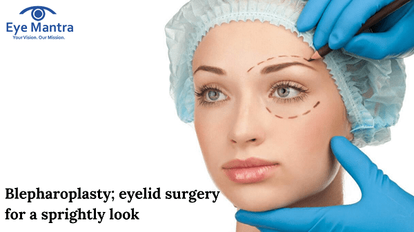 Blepharoplasty; eyelid surgery for a sprightly look