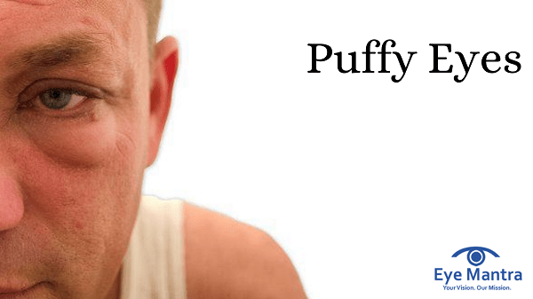 Puffy Eyes