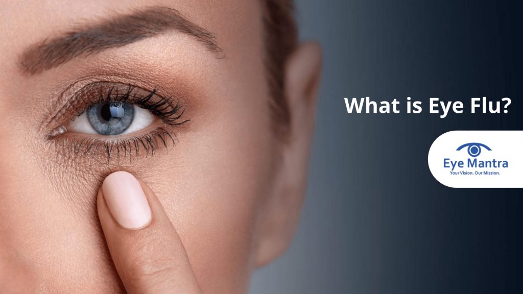 What is Eye Flu