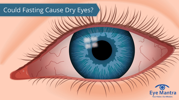 Could Fasting Cause Dry Eyes