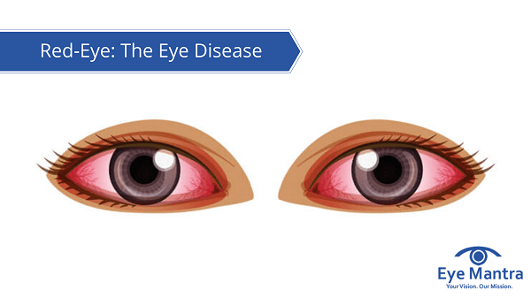 Red-Eye Disease