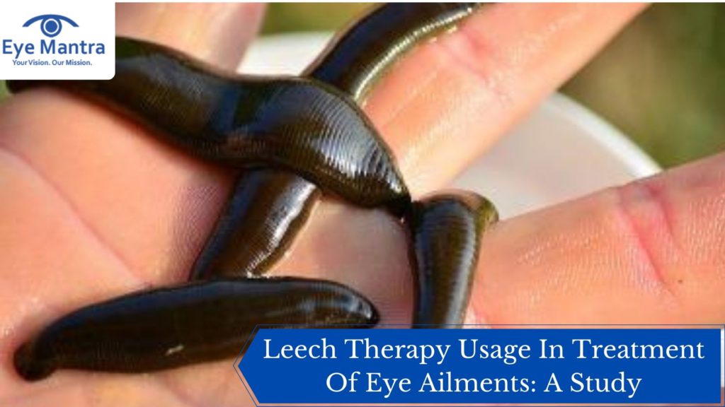 Leech Therapy Usage In Treatment Of Eye Ailments: A Study