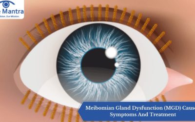 Meibomian Gland Dysfunction (MGD) Causes, Symptoms And Treatment