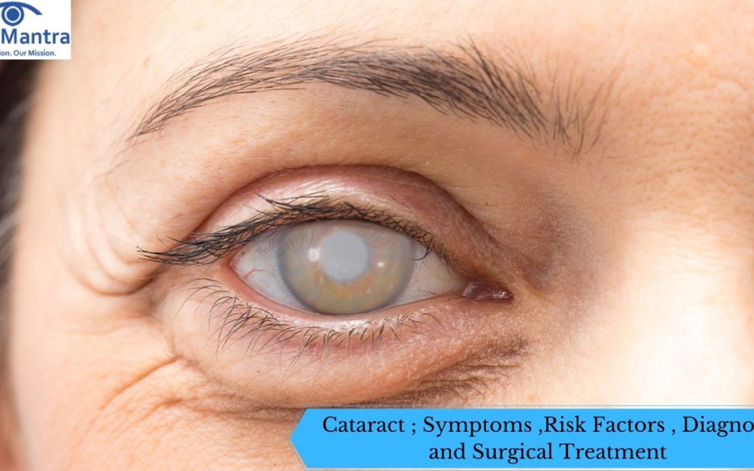 Cataract ; Symptoms ,Risk Factors , Diagnosis and Surgical Treatment
