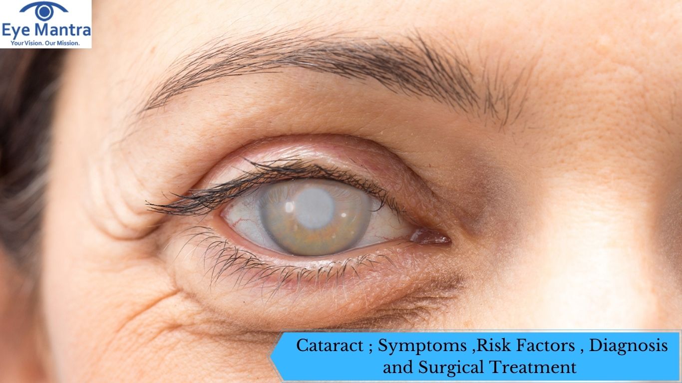 Cataract Symptoms Risk Factors Diagnosis And Surgical Treatment