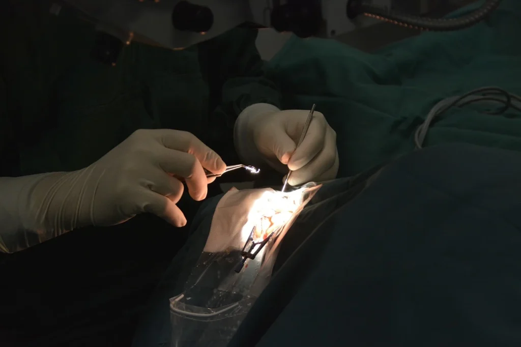 traditional vs laser cataract surgery