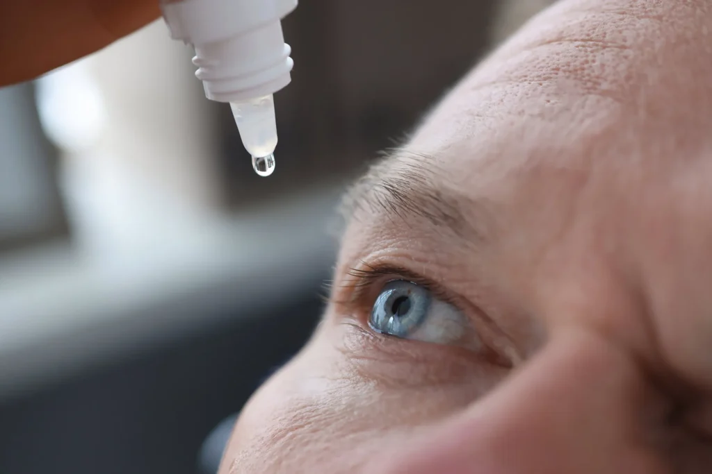 Types of Eye Drops for Dry Eyes